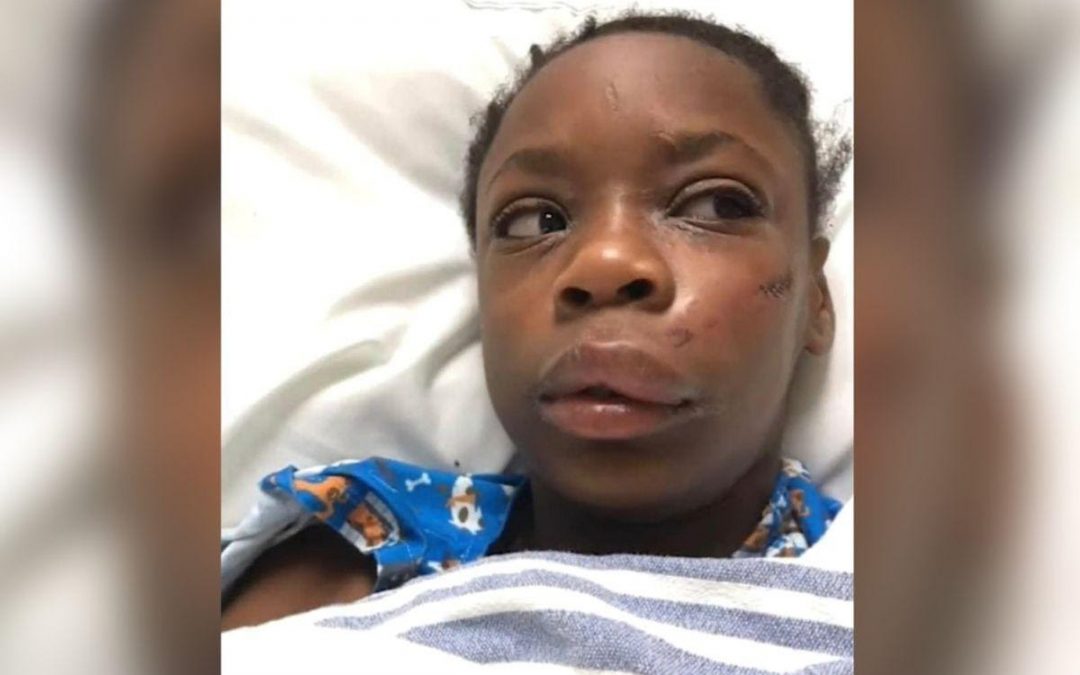 Kansas City girl reportedly beat unconscious in alleged racist attack